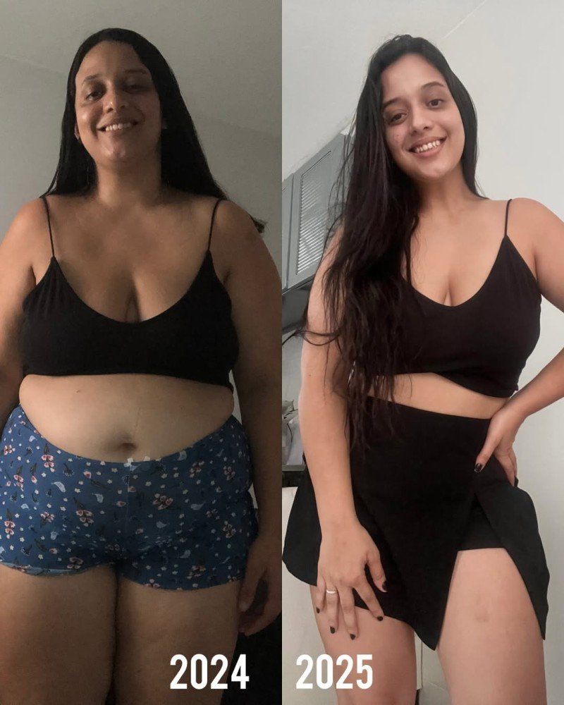 Antes do Mounjaro